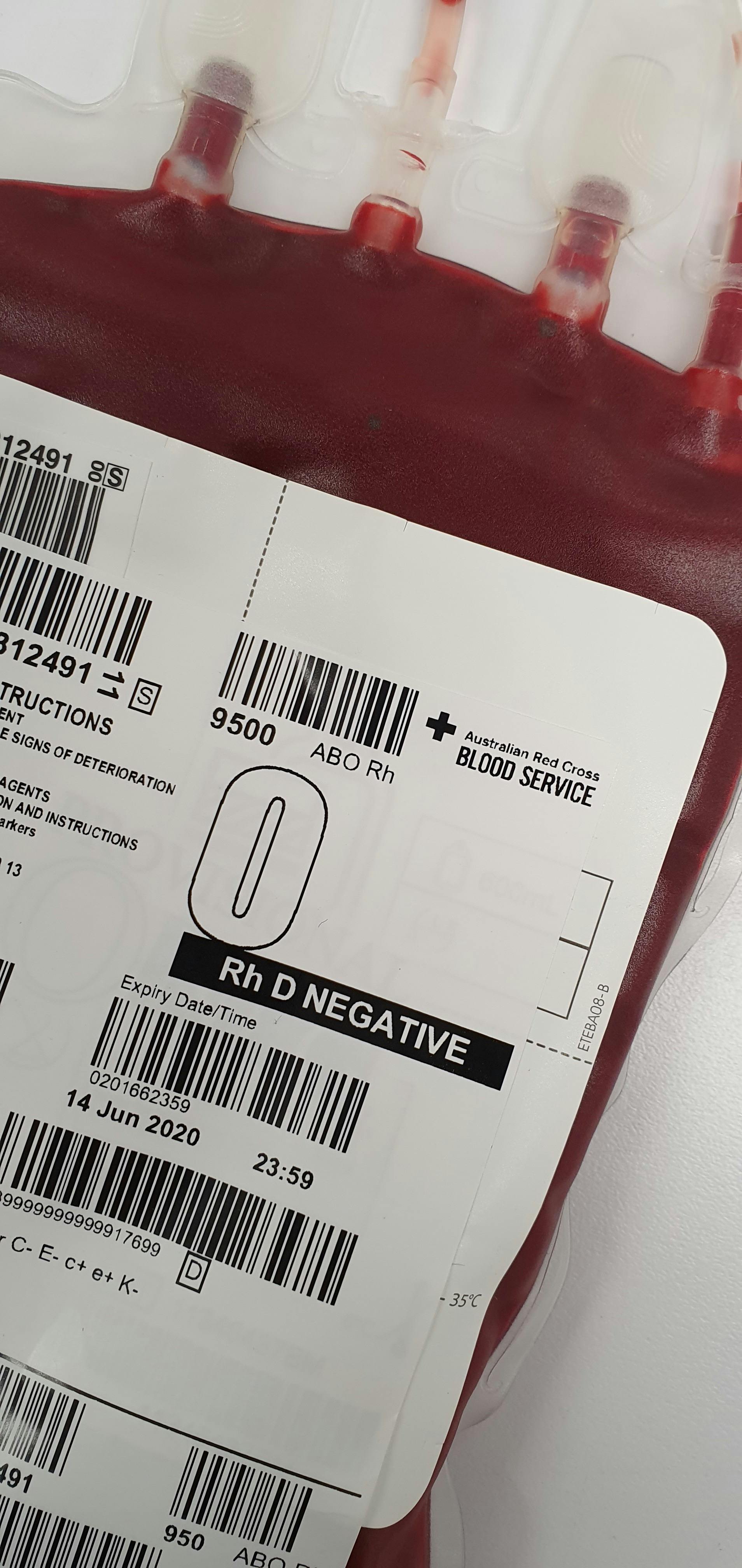A Close-Up Shot of a Blood Bag