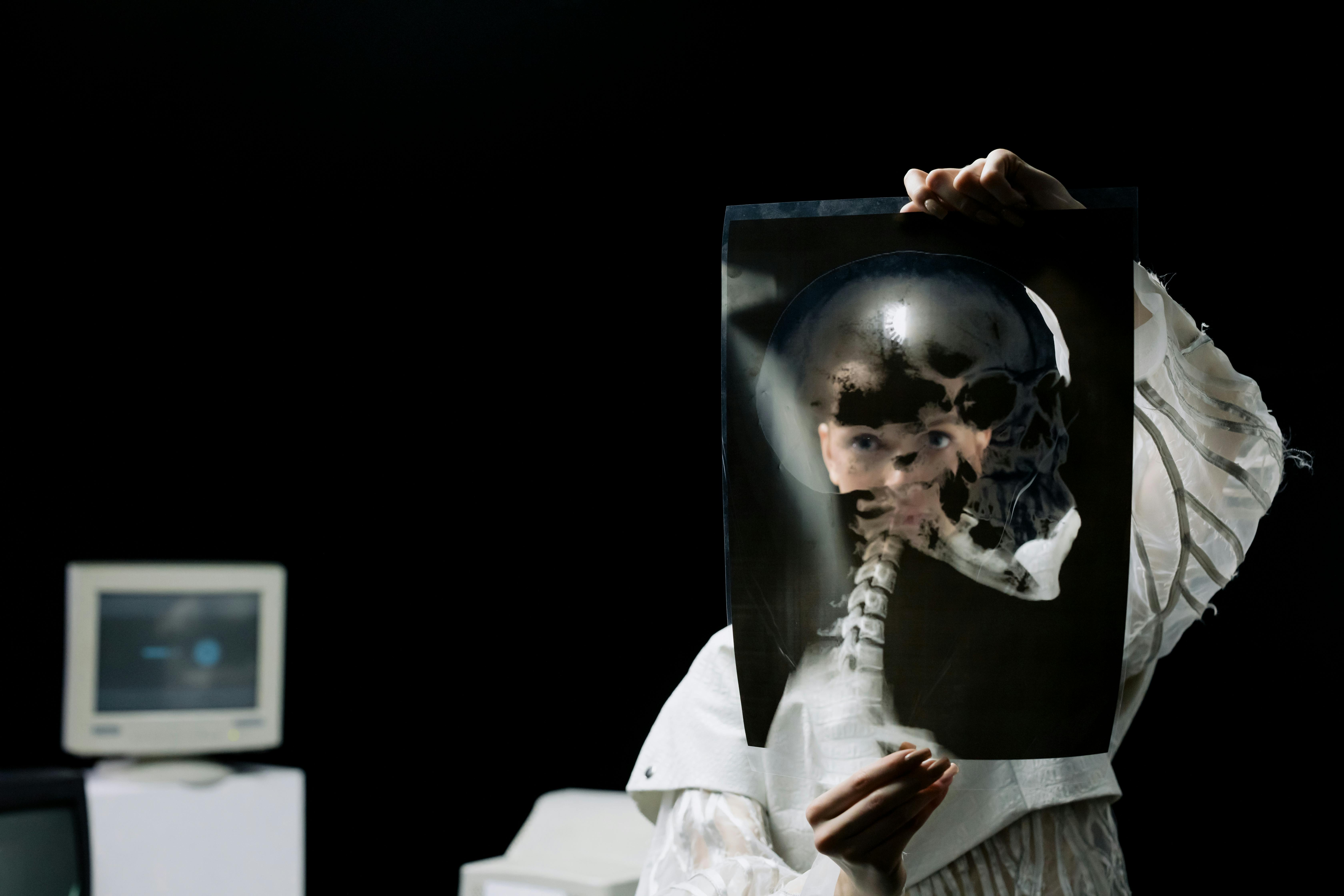 Person Holding an X-Ray Film