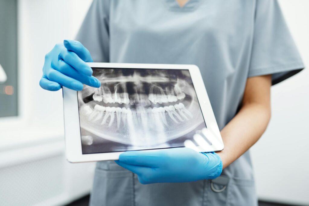 Root Canals Slogan Ideas