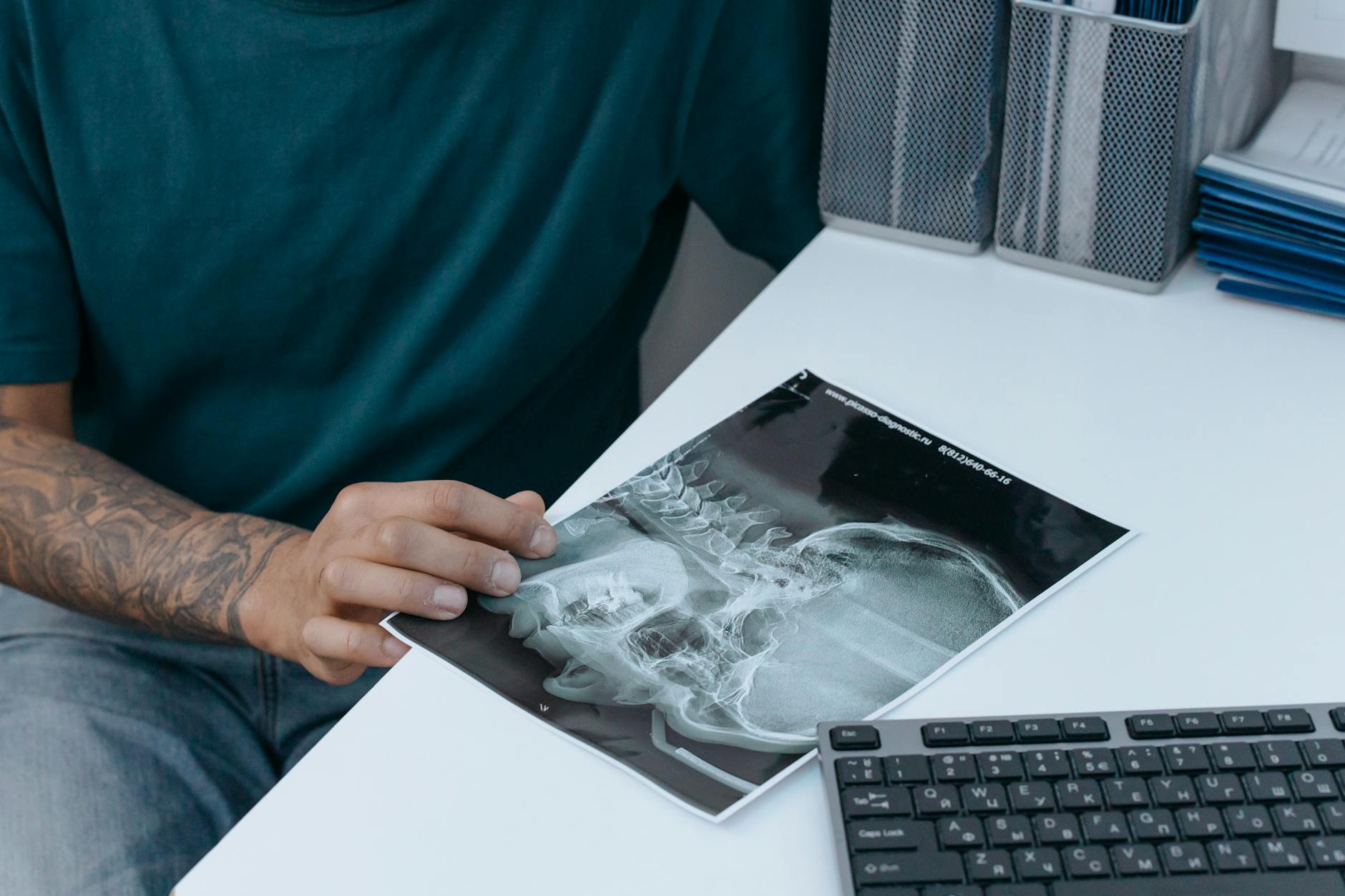 Close-Up Shot of a Person Holding an X-ray Image